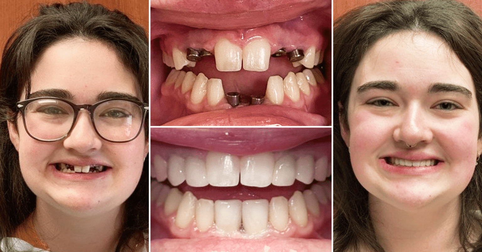 Premier Dental Associates Best Dentist in Lyndhurst OH