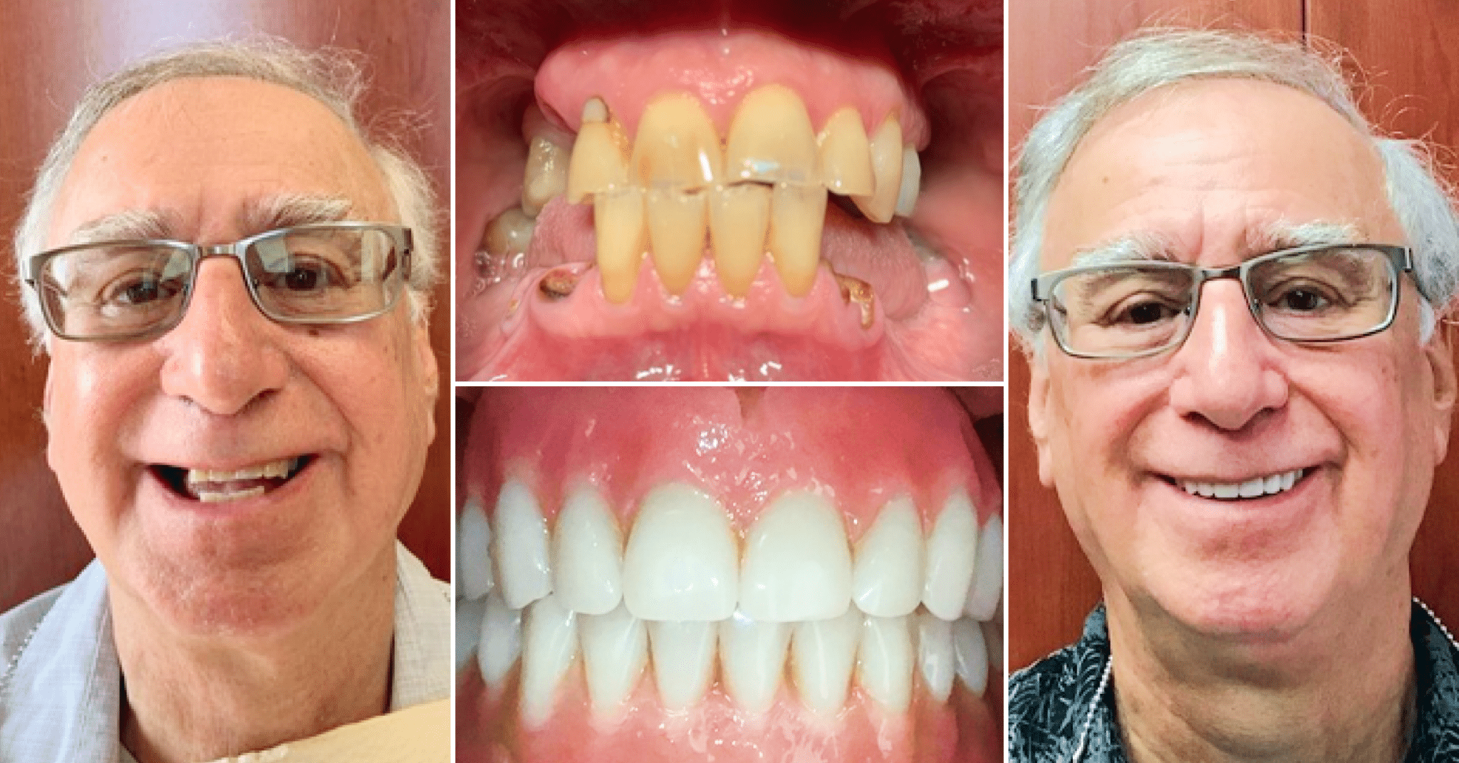 Premier Dental Associates Best Dentist in Lyndhurst OH