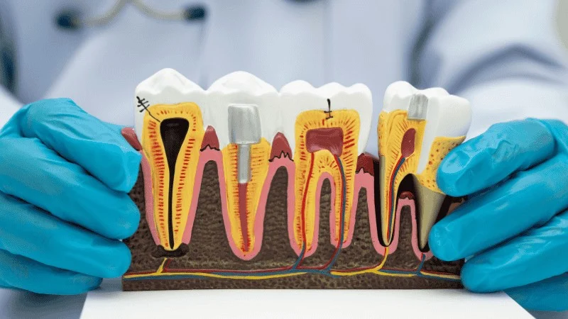 dental implant failure signs