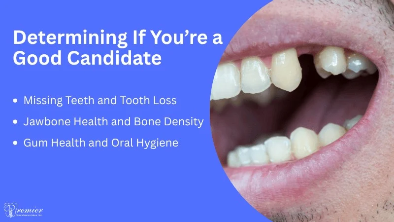 Are You a Candidate Key Qualification Factors (2)