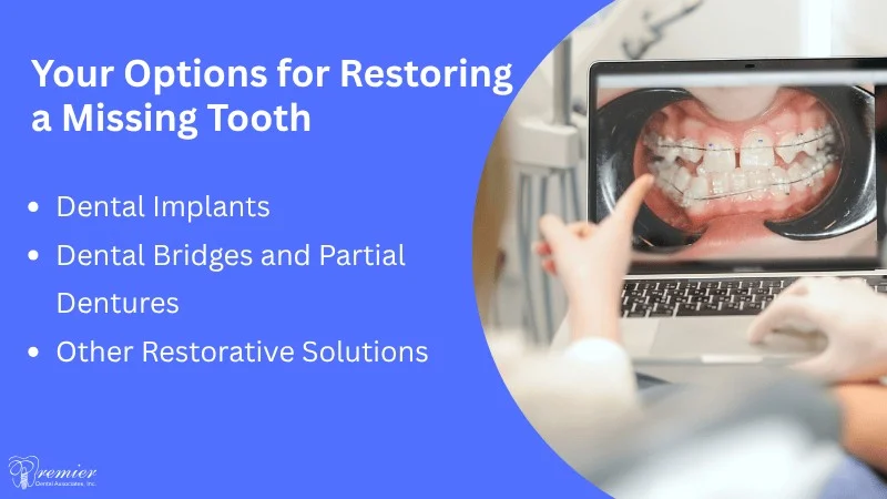 Tooth Replacement Options After Delay