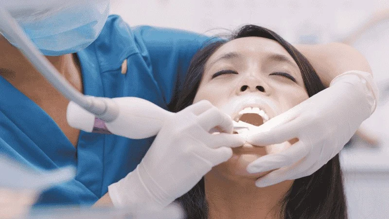 Deep Cleaning Scaling and Root Planing