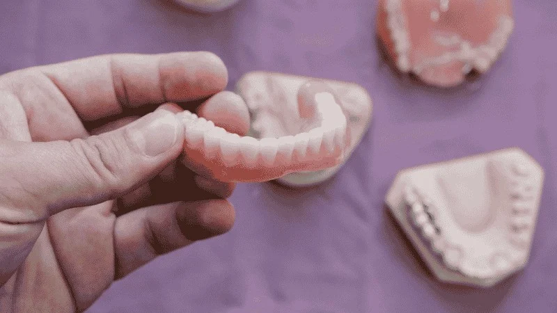 how long do dentures last