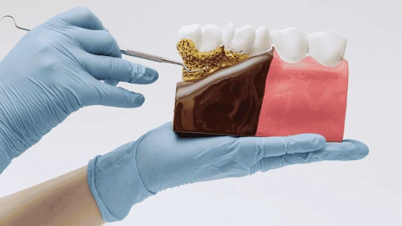 signs you need periodontal treatment