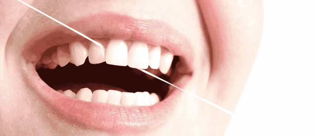 Oral Hygiene and Protection From Teeth Grinding
